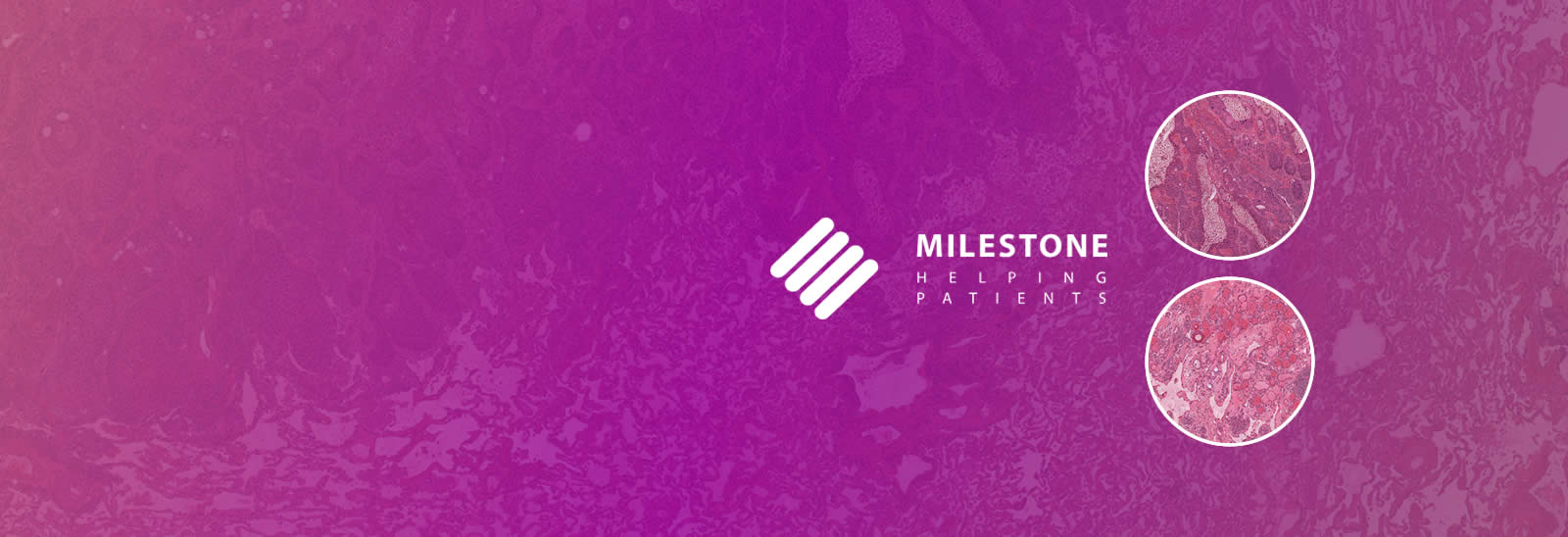 Milestone/Patoloji Ekipmanları